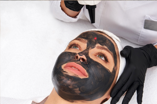 Carbon Laser Facial skin haven clinic dr. sampriti book appointment3