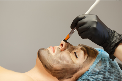 Carbon Laser Facial skin haven clinic dr. sampriti book appointment3