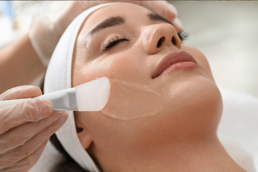 Chemical Peeling skin haven clinic dr. sampriti book appointment 2