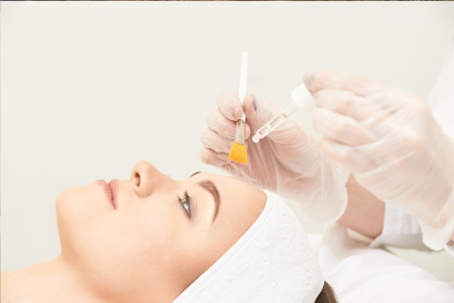 Chemical Peeling skin haven clinic dr. sampriti book appointment 2